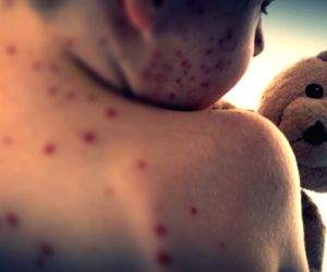 Global measles cases see 88pc jump in 2023 from 2022: WHO